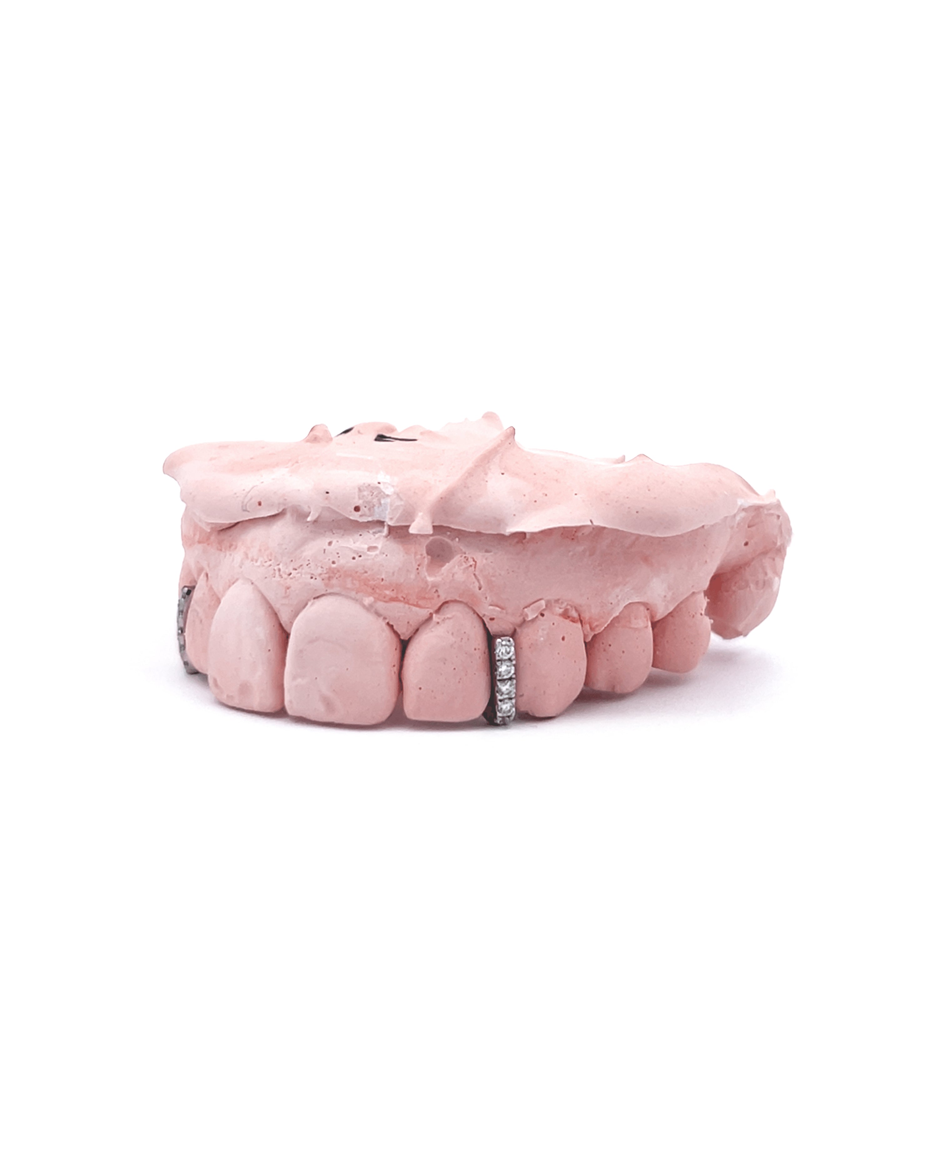 Diamond Gapfiller