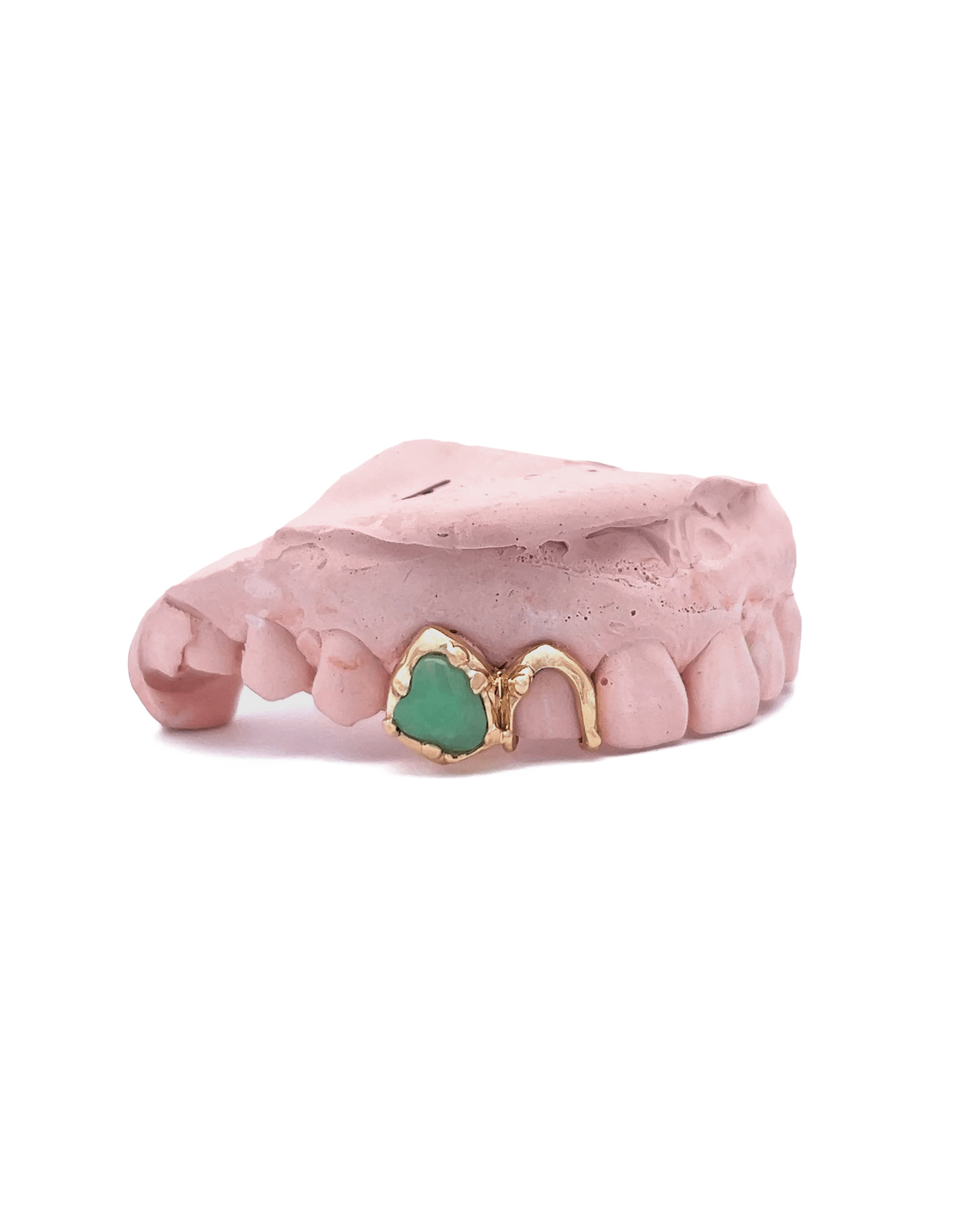 Organic Jade Inlay With U Cap