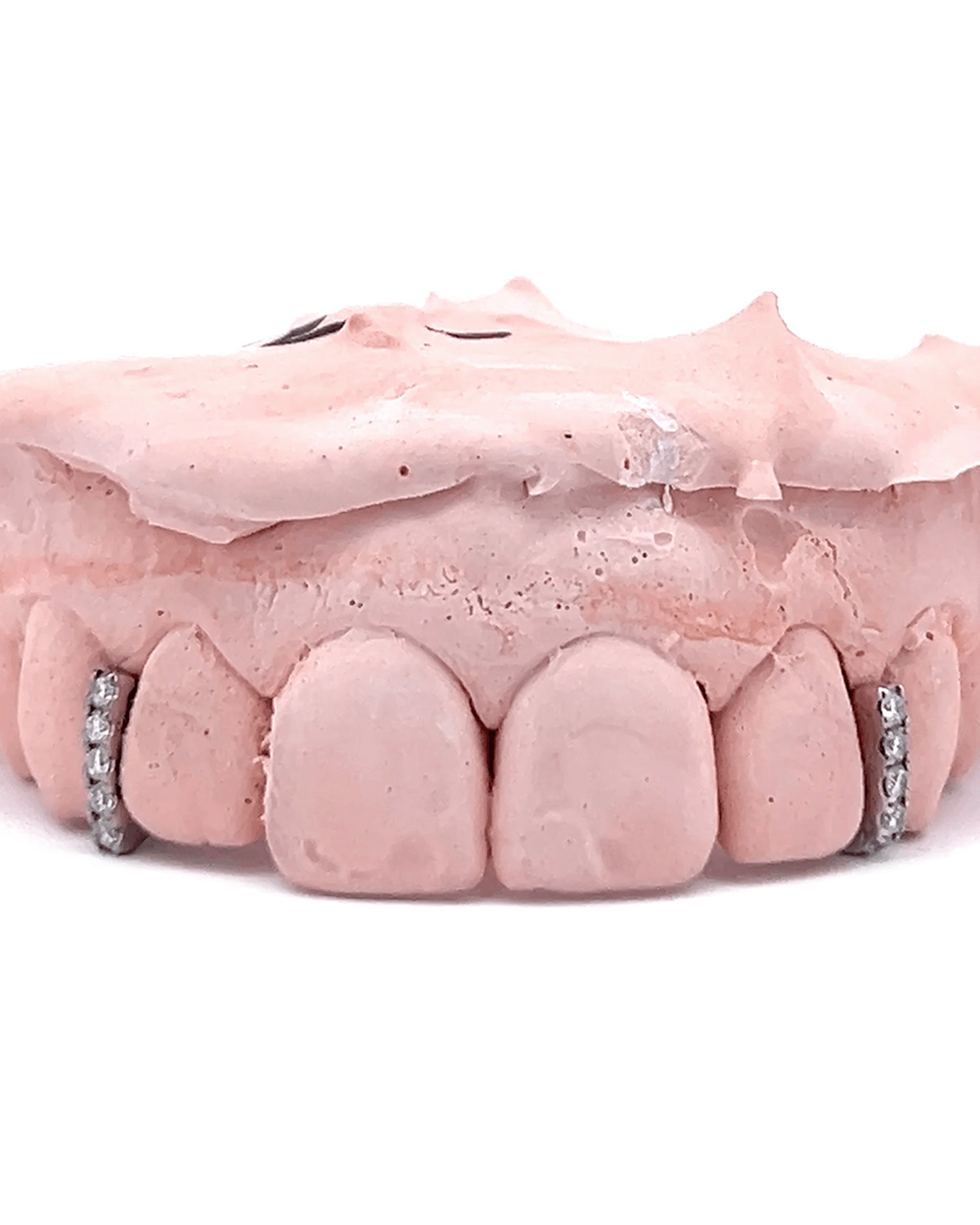 Diamond Gapfiller