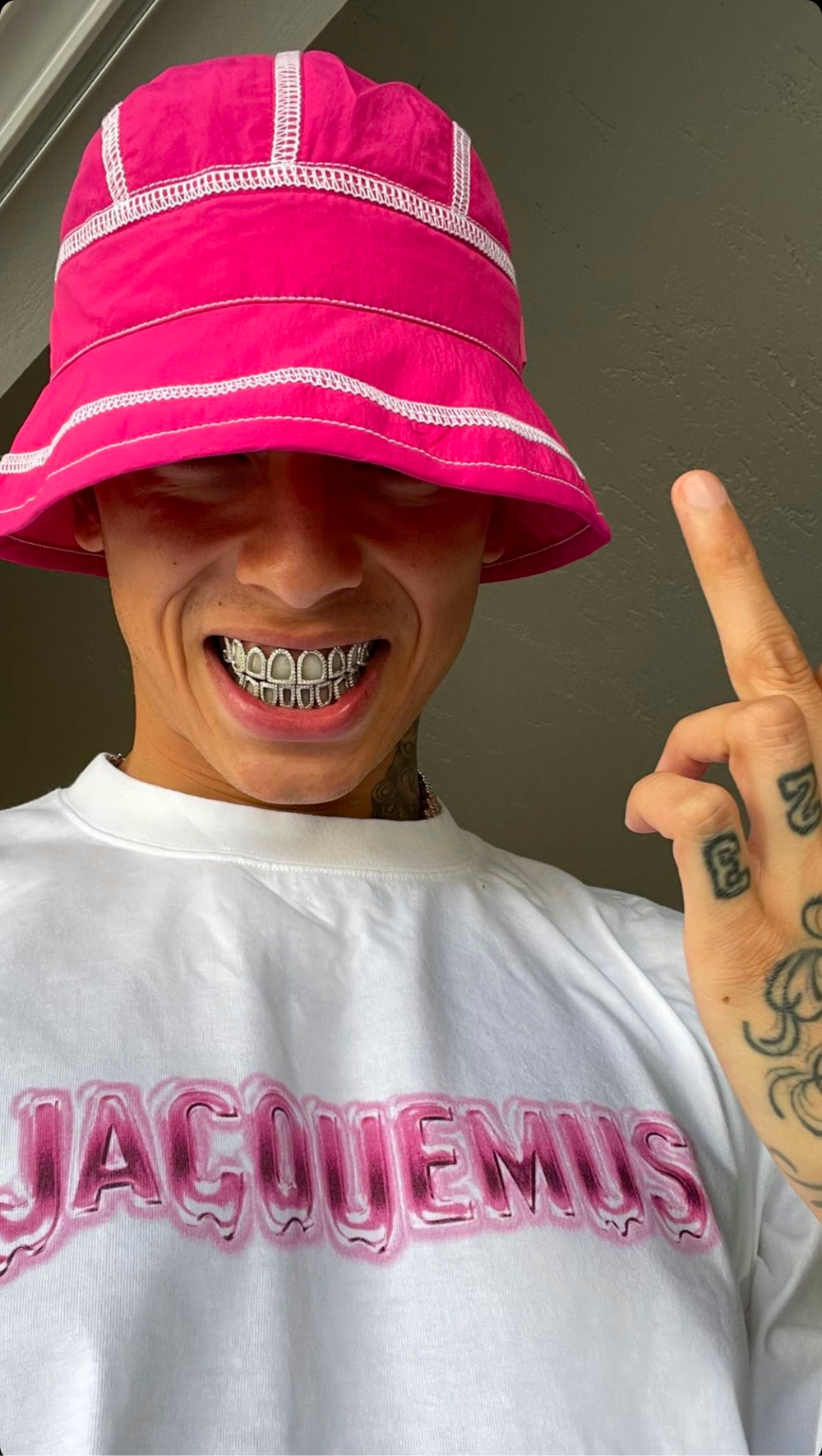 Custom grillz